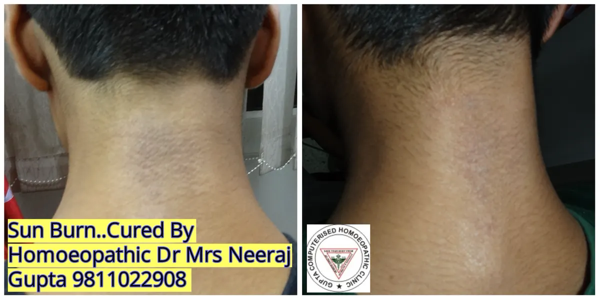 Skin Condition Treatment - Case 1
